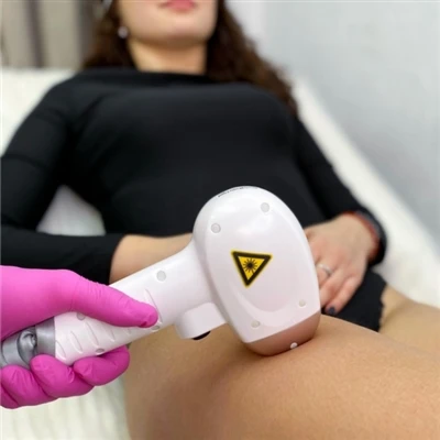 Kaj je diodni laserski stroj za odstranjevanje dlak?